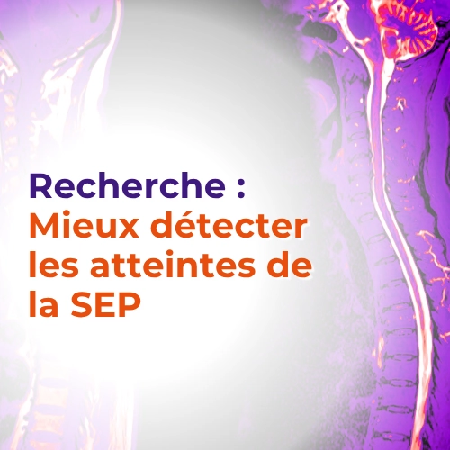 Nouvelle technologie IRM pour mieux détecter les atteintes de la SEP