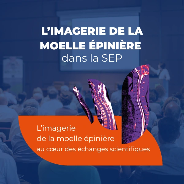 Moelle épinière et sclérose en plaques : les nouvelles avancées de l’imagerie
